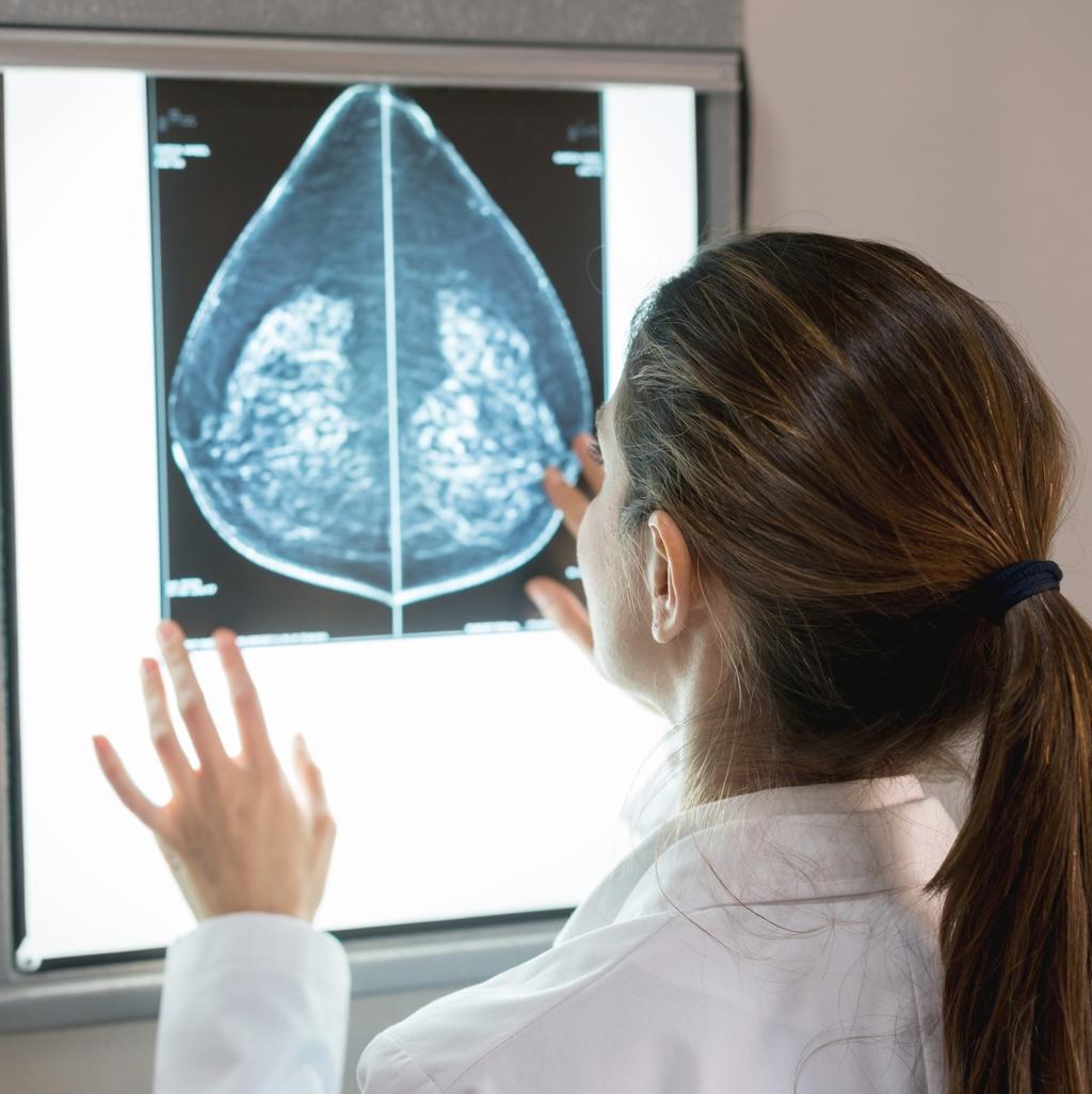 Mammography breast imaging