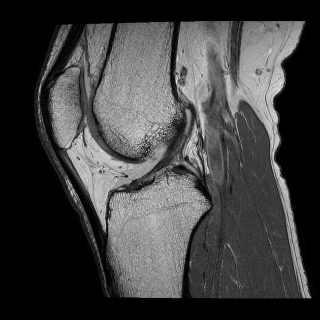 Musculoskeletal MSK imaging