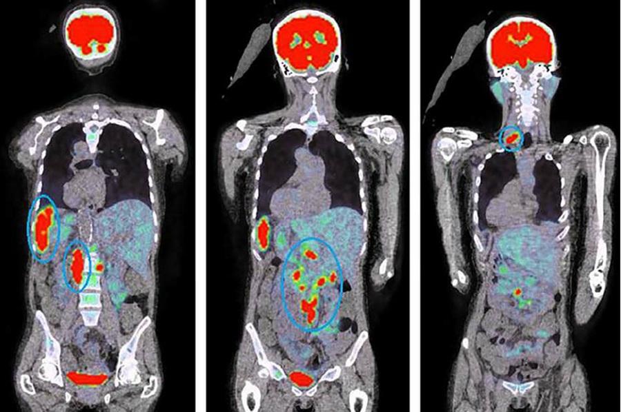 Oncology and body imaging