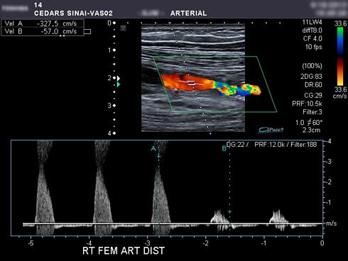 Ultrasound and Doppler imaging