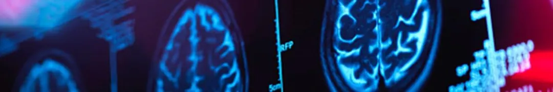 Radiology team reviewing imaging studies